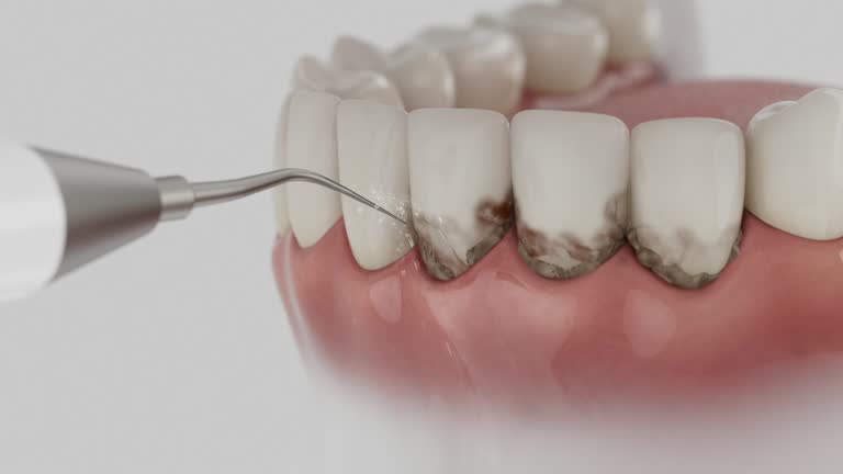 Trusted Wisdom Tooth Removal service in High Springs, FL - Dentist Open Now